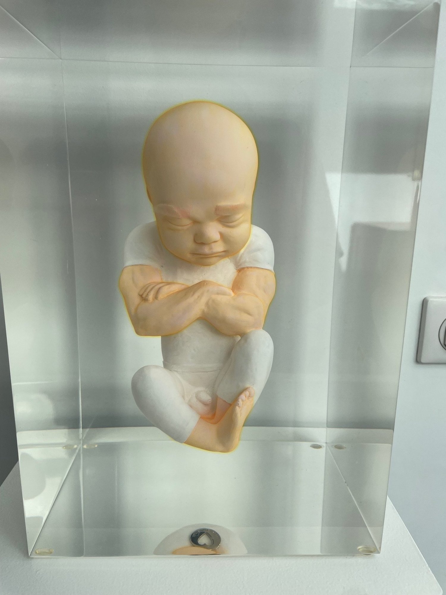 Clean Foetus, œuvre de Alexandre Nicolas, vue 1